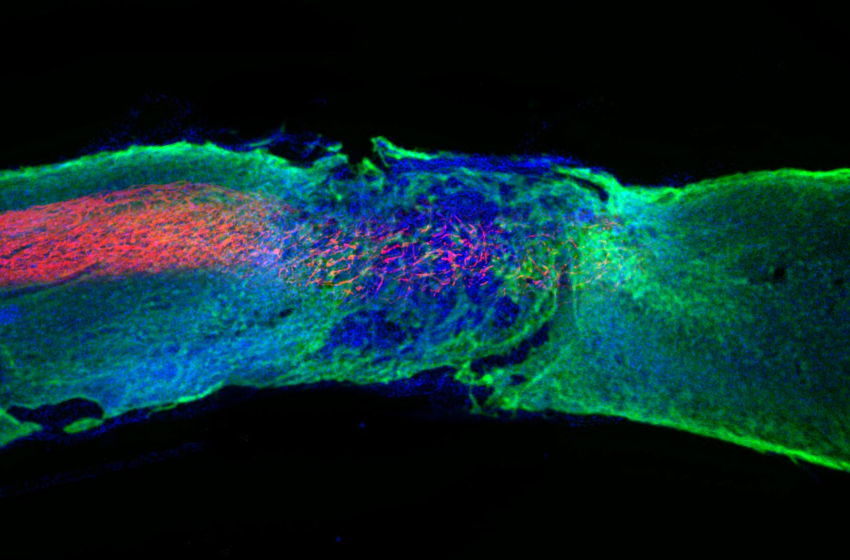  Regenerative Medicine Breakthrough: “Dancing Molecules” Successfully Repair Severe Spinal Cord Injuries – SciTechDaily