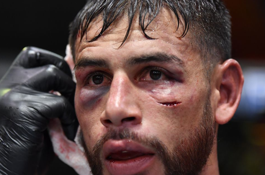  Yair Rodriguez shows off mangled foot, gives post-fight statement from hospital bed after UFC Vegas 42 – MMA Fighting