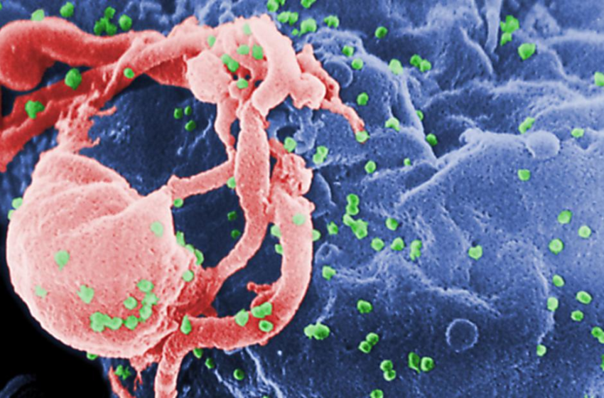  A second HIV patient may have been cured of infection without stem cell treatment, in extremely rare case – CNN