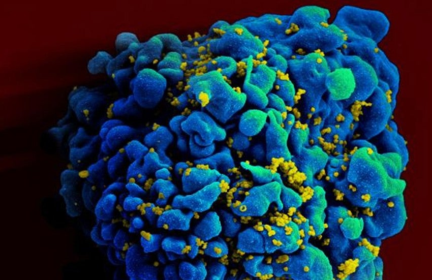  Second HIV patient may have been naturally cured, scientists say | TheHill – The Hill