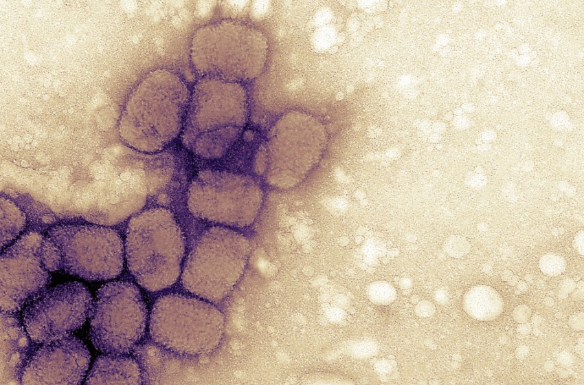  Vials found in Pennsylvania lab did not contain smallpox as labeled, CDC says – NBC News