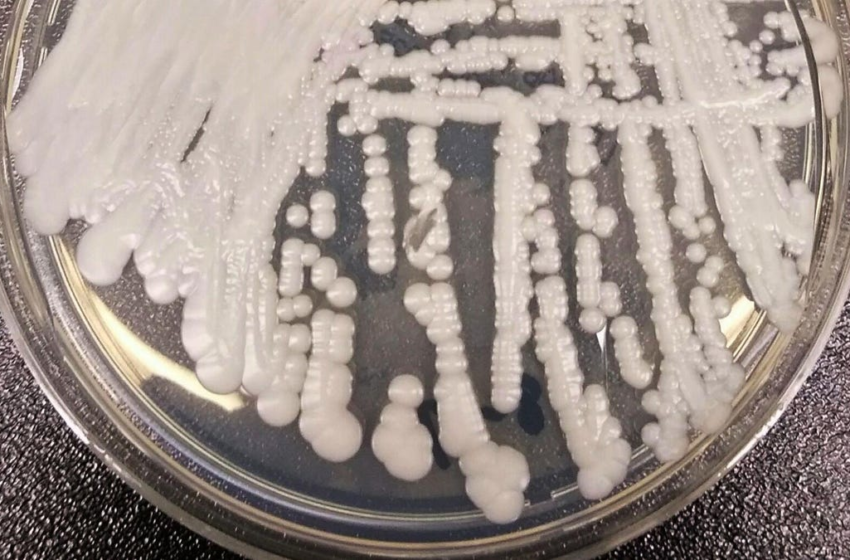  Deadly Superbug Yeast Sickens Patients at Oregon Hospital – Gizmodo