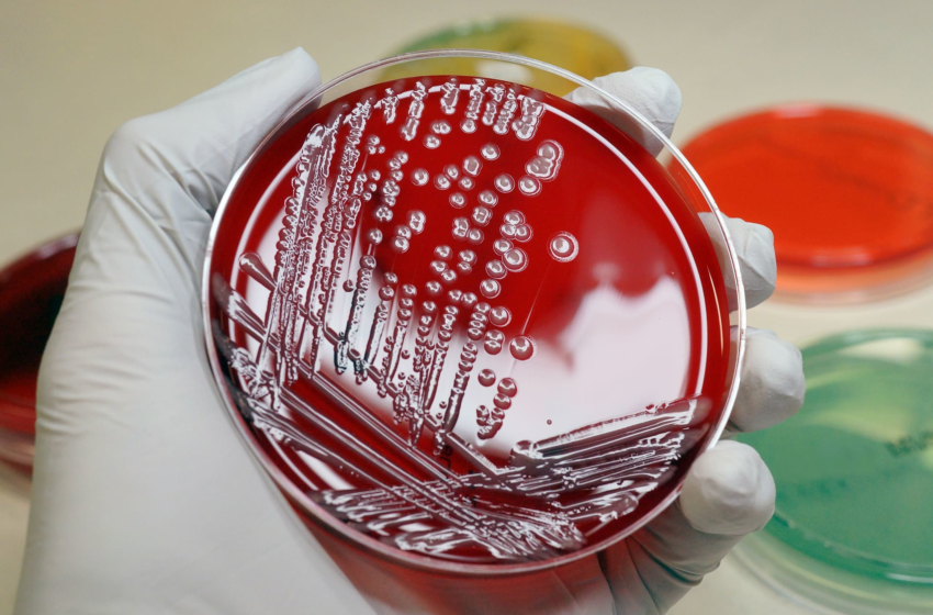  Antibiotic-resistant infections are a ‘major global health threat’ that’s killing millions, scientists say – CNBC