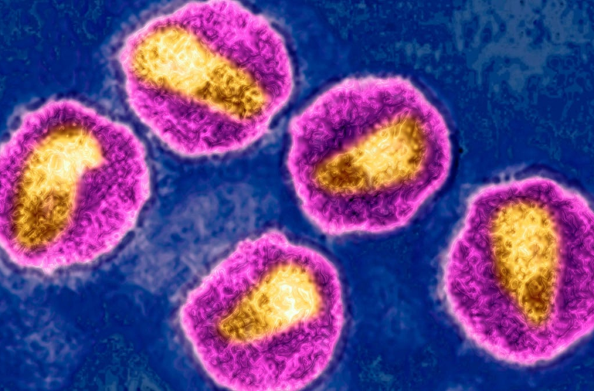  A Highly Virulent Variant of HIV Has Been Discovered in the Netherlands – Gizmodo