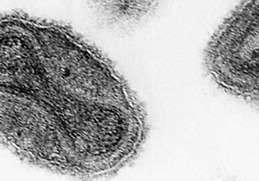 Vials Labeled ‘Smallpox’ Are Found in Pennsylvania Laboratory - The New ...